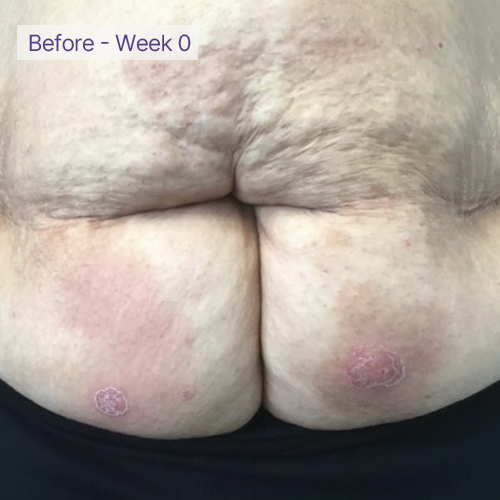 Belly before