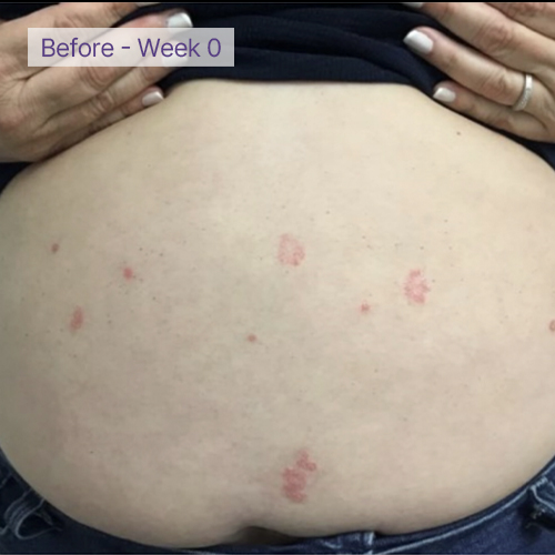 Belly before