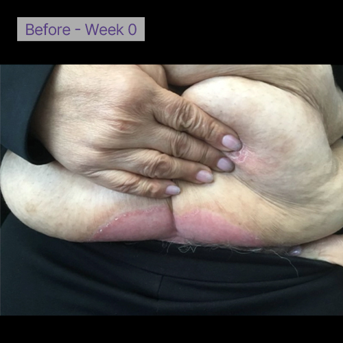 Belly before