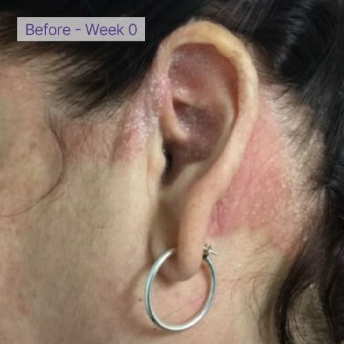 Ear before