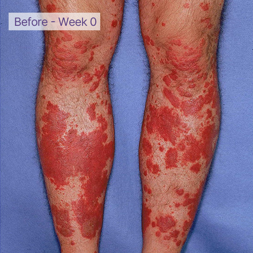 legs before
